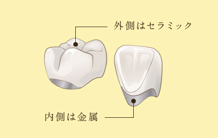外側はセラミック、内側は金属